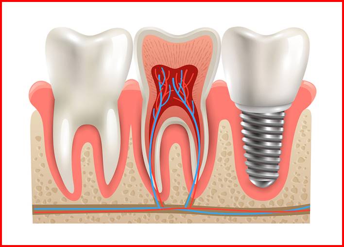 Restorative Dentistry for Missing Teeth
